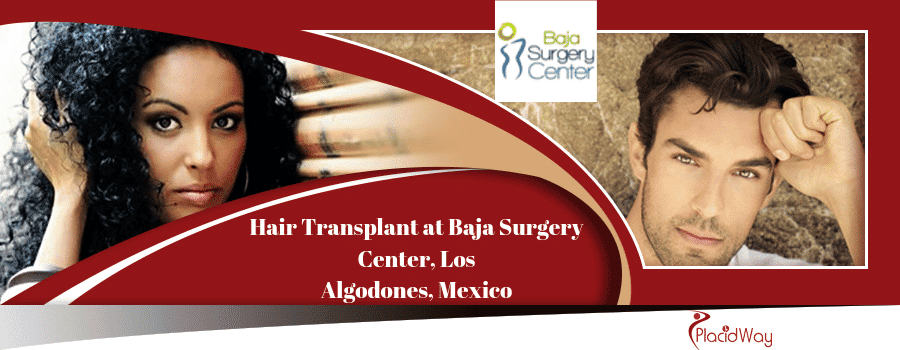 Hair Transplant Mexico